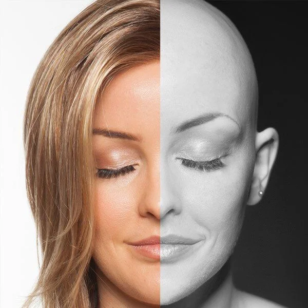 Chemotherapy & alopecia wigs