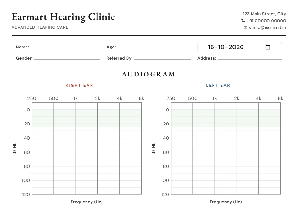 Free Online Audiogram Generator & Hearing Report | EarMart
