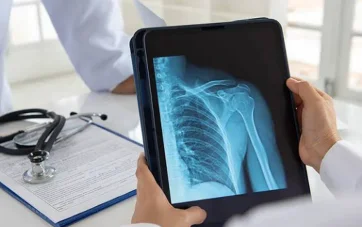 Digital X-Rays