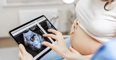 Ultrasound(Sonography)