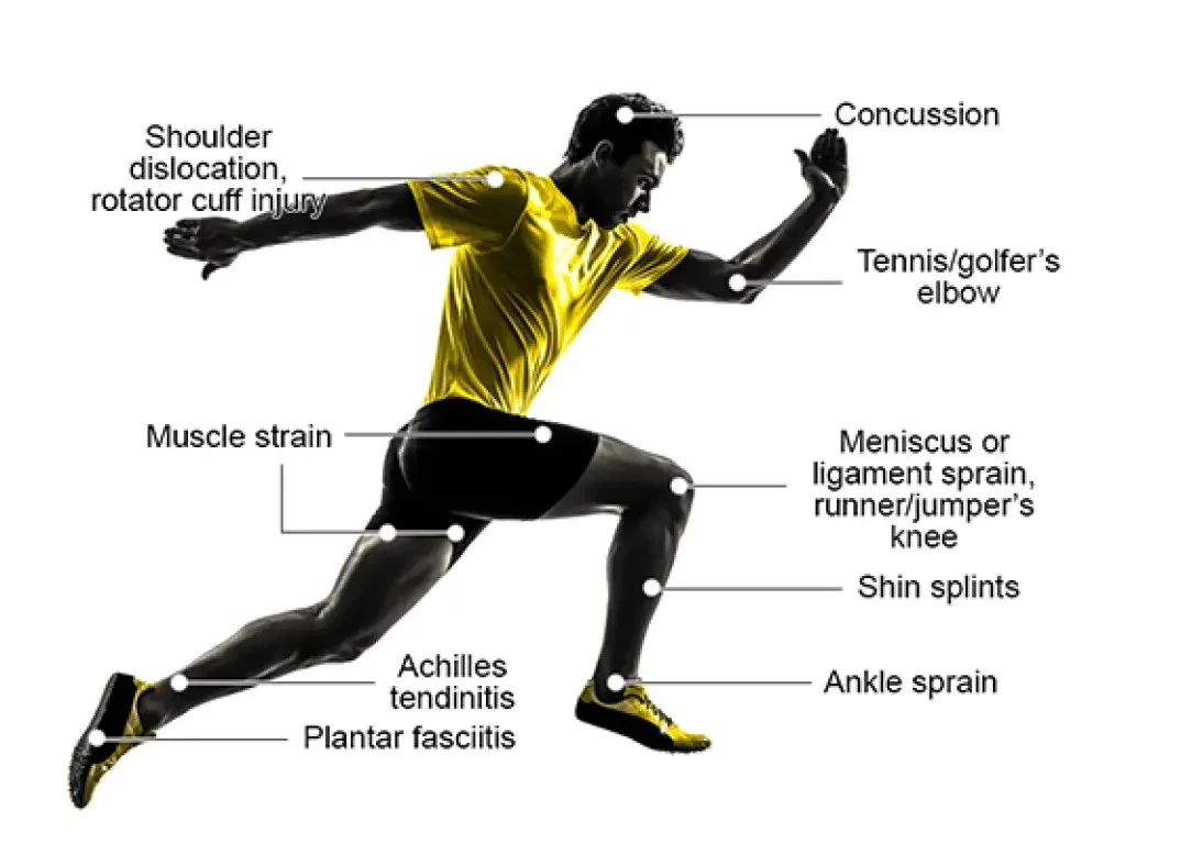 SPORTS INJURIES