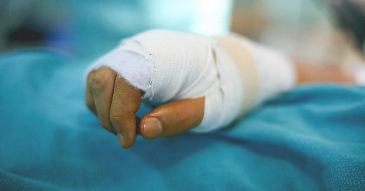 Things to know in case of an Injury to your hand